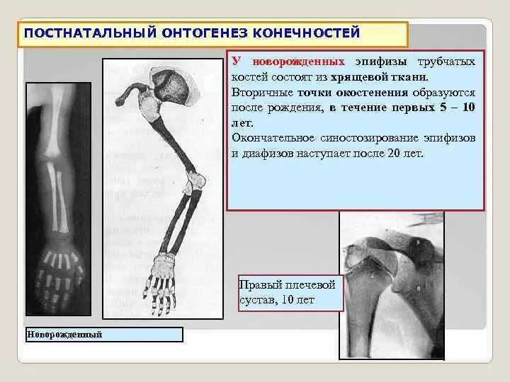 Точки окостенения трубчатых костей. Синостозирование костей это. Вторичные точки окостенения в эпифизах. Развитие осевого скелета в онтогенезе. Почему костю назвали костей