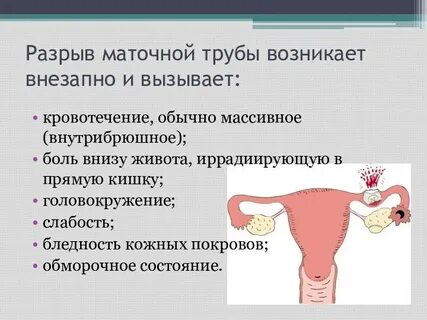 Обильное кровотечение беременность