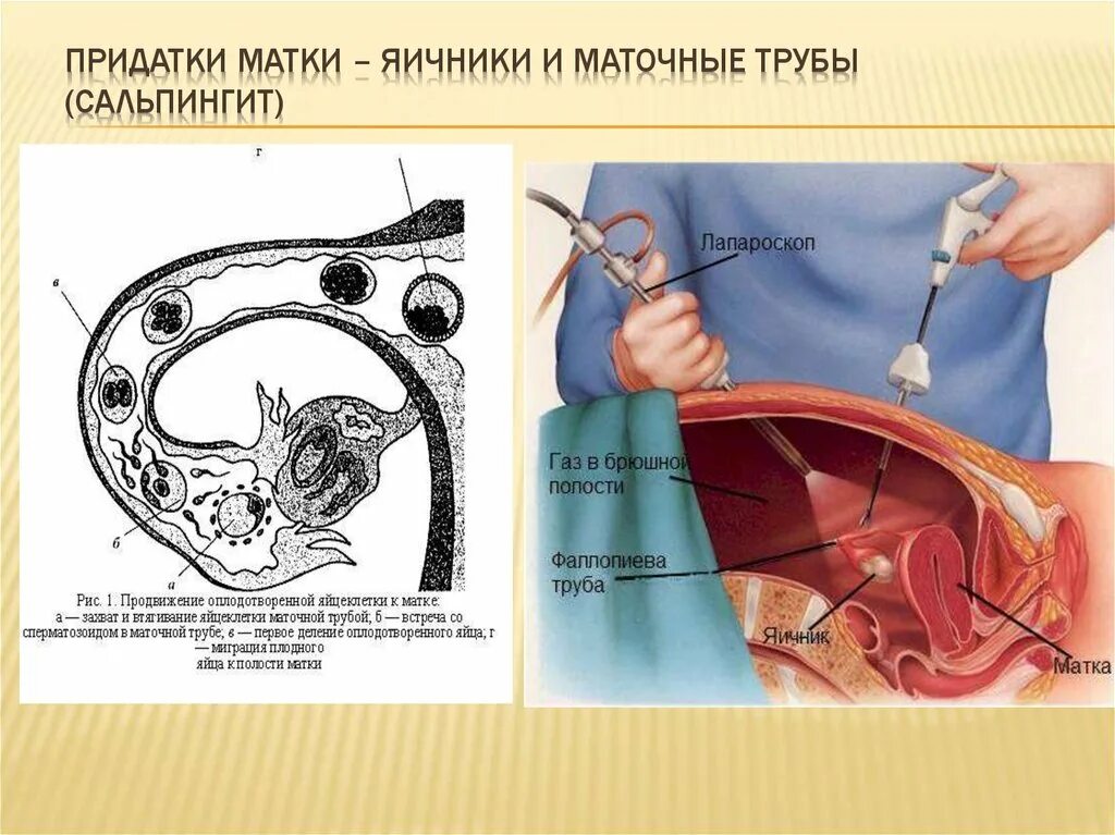 После второго полового акта. Яичник маточная труба и матка. Расположение матки и яичников. Строение матки яичников и придатков. Матка и яичники расположение.