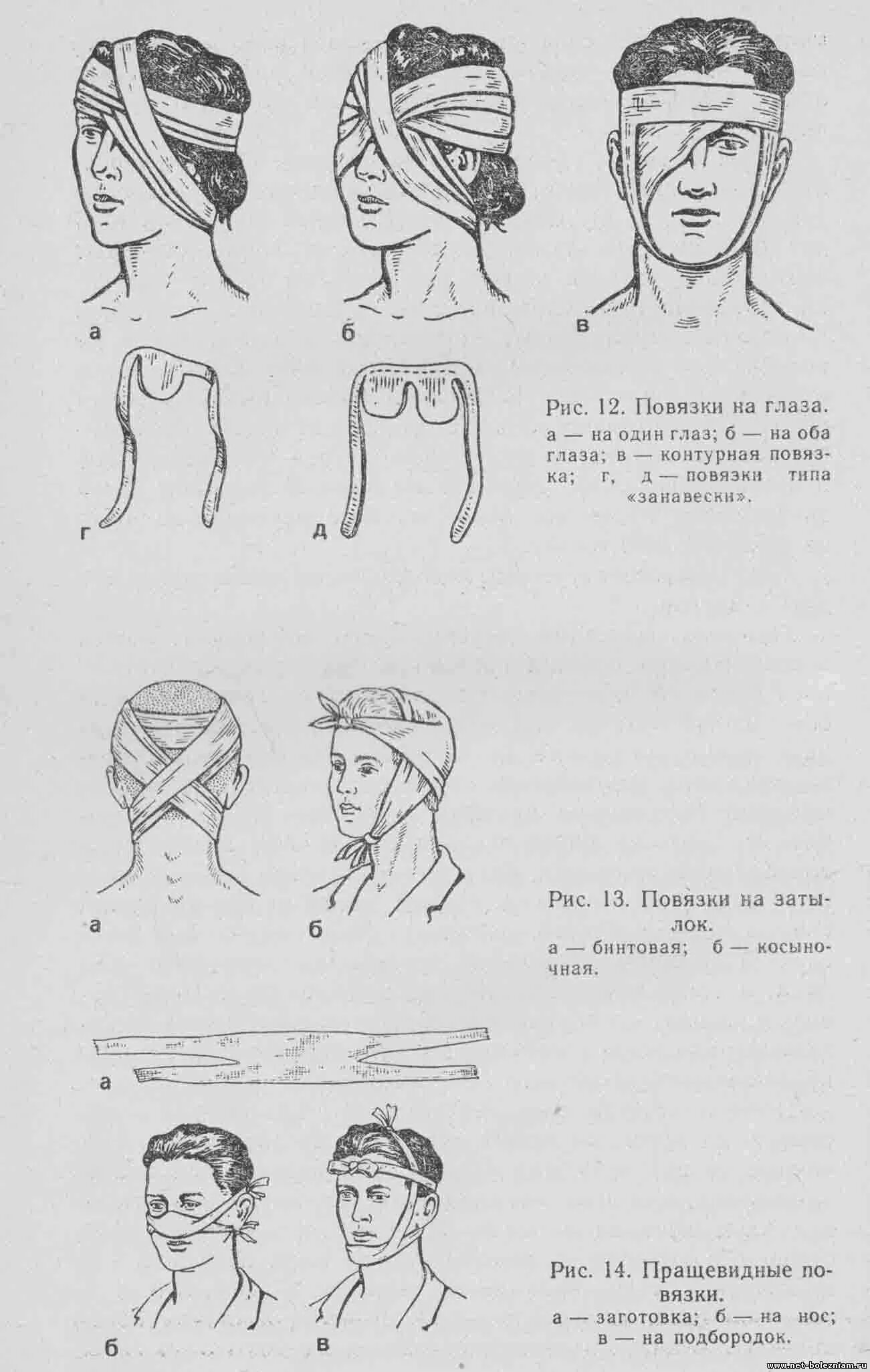 Перевязка шеи. Наложение бинтовой повязки на затылок. Бинтовые перевязки головы. Схемы наложения бинтовых повязок. Десмургия Косыночная повязка.