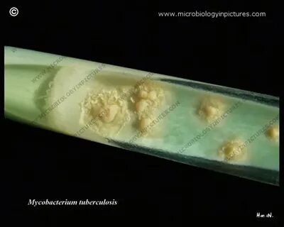 Микобактерии туберкулеза питательные среды
