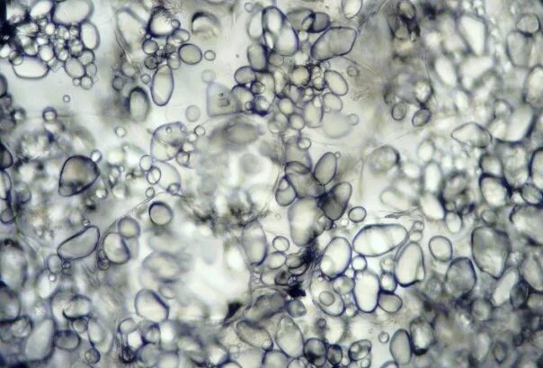 Хромопласт микрофотография. Лейкопласты амилопласты. Хромопласт электронная микрофотография. Лейкопласты микрофотография. Микрофотография лейкопласта.