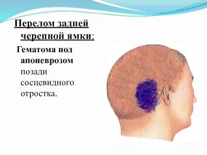 Содержимое средней черепной ямки