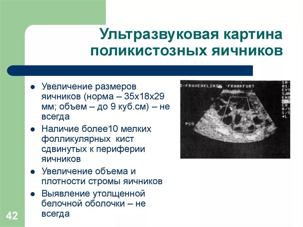 Норма правого яичника