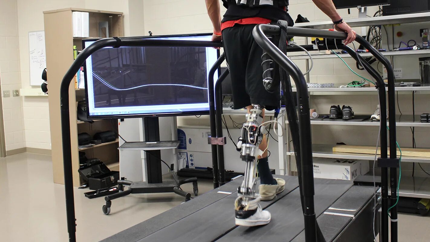 Бионический протез ноги. Роботизированные протезы. Биомеханический протез ноги. Высокотехнологичные протезы. Протезист конечностей