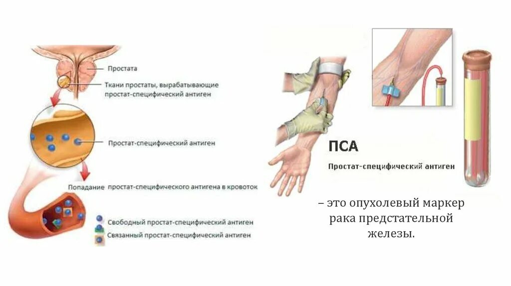 Давление простата. Скрининг предстательной железы. Скрининг новообразований предстательной железы. Скрининг онкологических заболеваний.