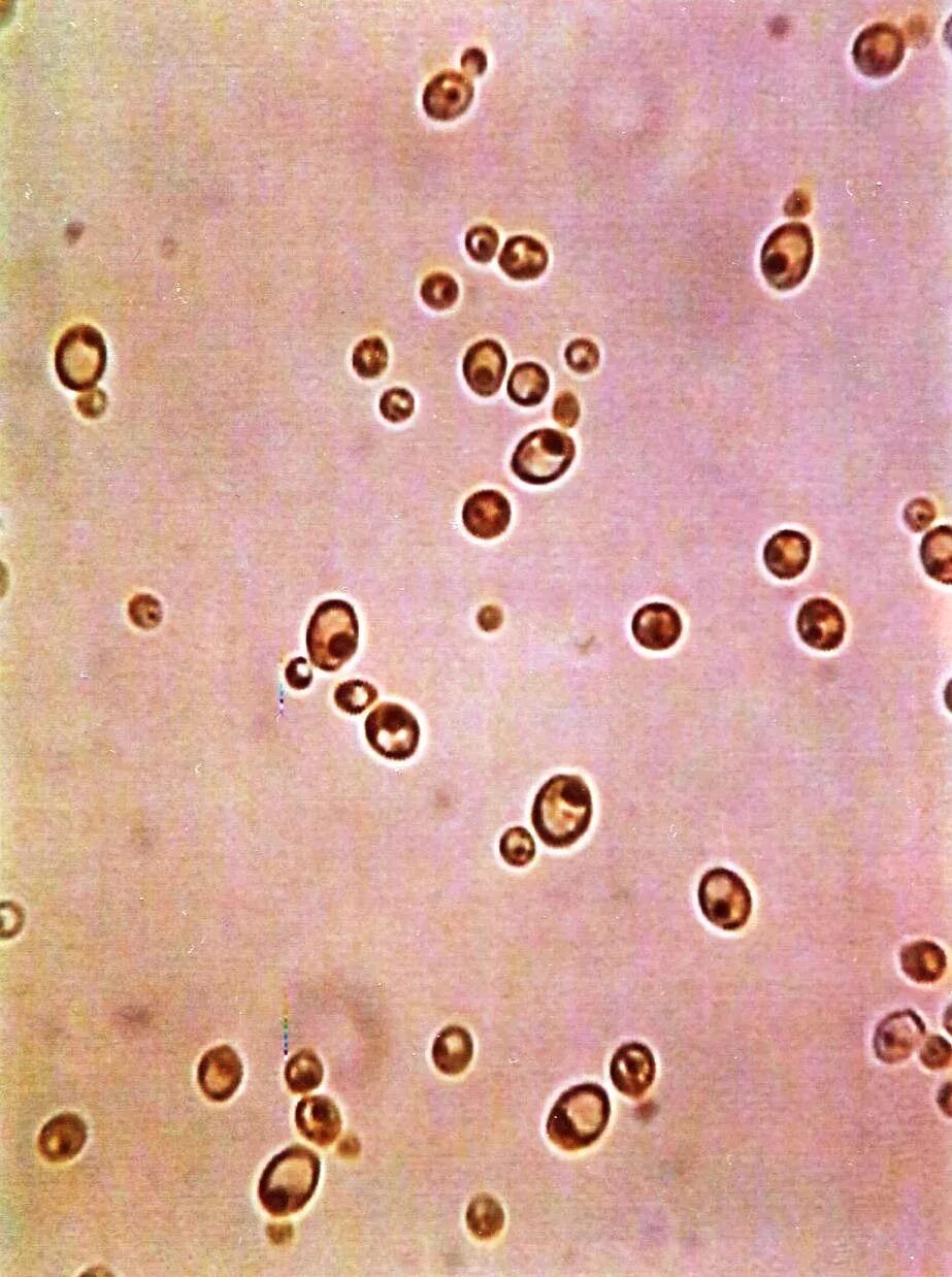 Копрограмма обнаружены грибы. Грибы кандида микроскопия. Candida albicans микроскопия.