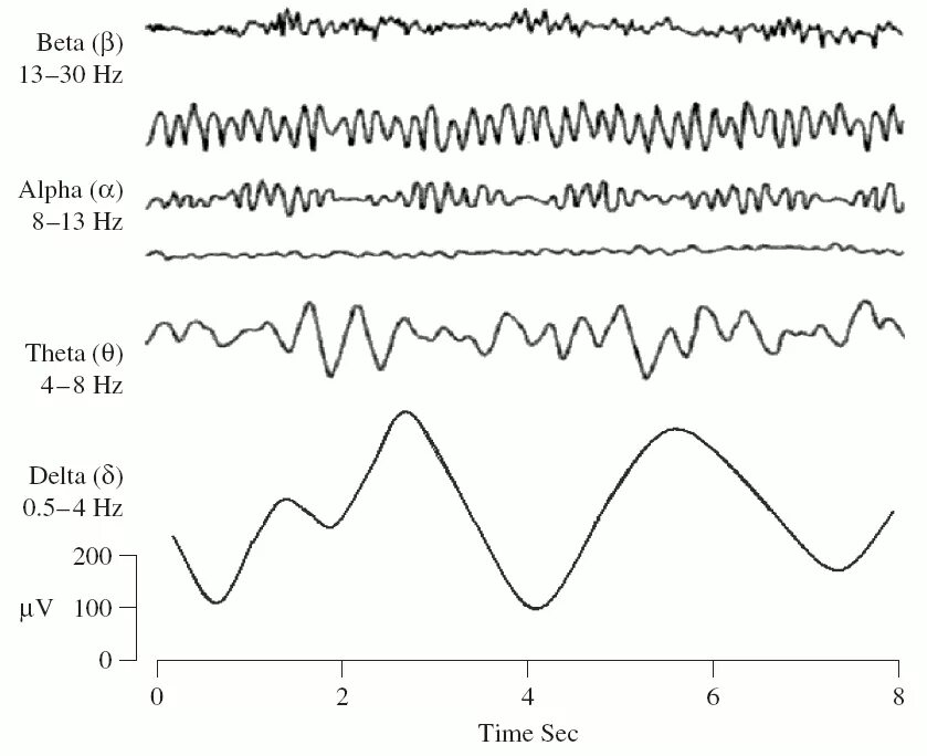 Альфа бета тета. ЭЭГ Альфа бета тета Дельта ритмы. Альфа ритм мозга ЭЭГ. Гамма ритмы головного мозга на ЭЭГ. Дельта ритм ЭЭГ.