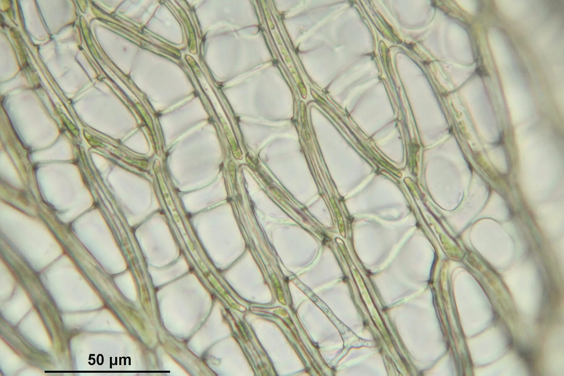 Водоносные клетки в листьях имеет. Хлорофиллоносные клетки сфагнума. Гиалиновые клетки сфагнума. Водоносная ткань сфагнума. Водоносные клетки сфагнума.