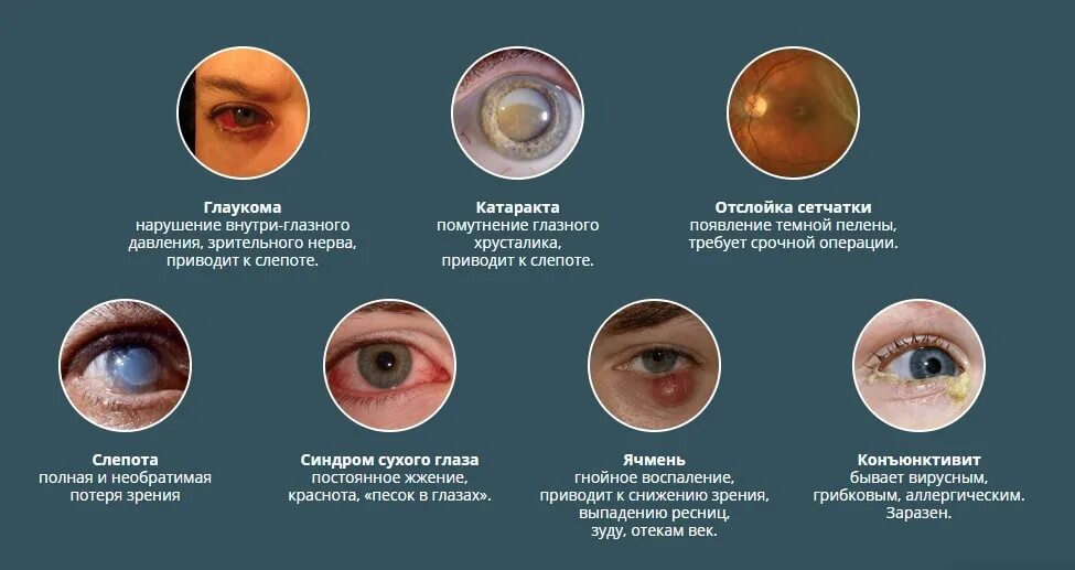 Причина появления темных. Нарушение зрения. Заболевания глаз со слепотой.