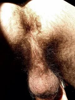 Slideshow pictures of hairy balls.