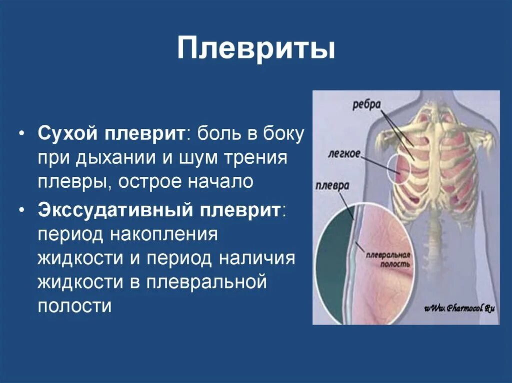 Колет в легких. Болит правое легкое при вдохе снизу. Плеврит боль.