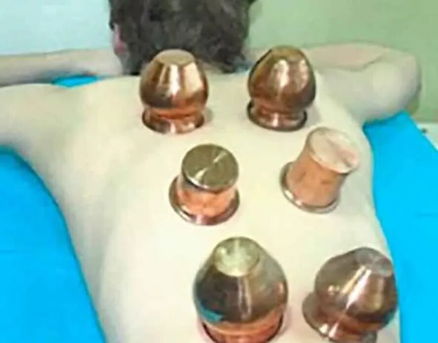 Лечение медью