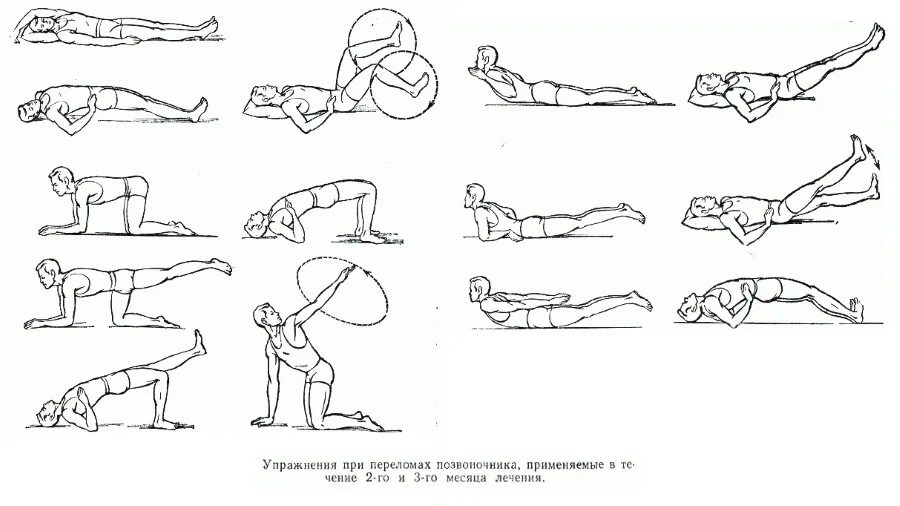 Какие после операции упражнение. ЛФК при реабилитации компрессионного перелома позвоночника. Лечебная физкультура при компрессионном переломе 11 позвонка. Лечебная гимнастика при переломах таза. Лечебная гимнастика после перелома костей таза.