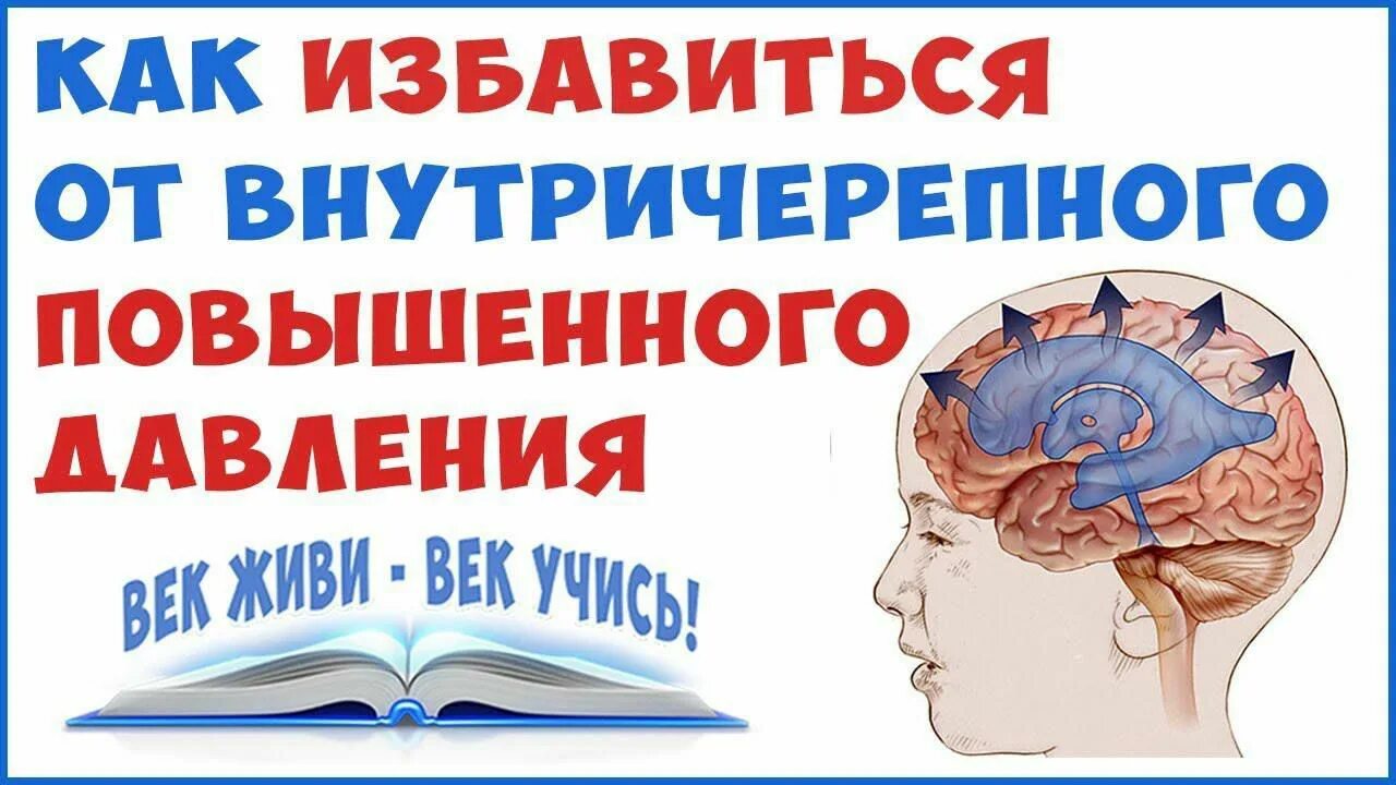 Как снизить черепное давление. Как избавиться от внутричерепного. внутричерепное давление лечение. черепное давление лекарства. светобоязнь внутричерепное давление.