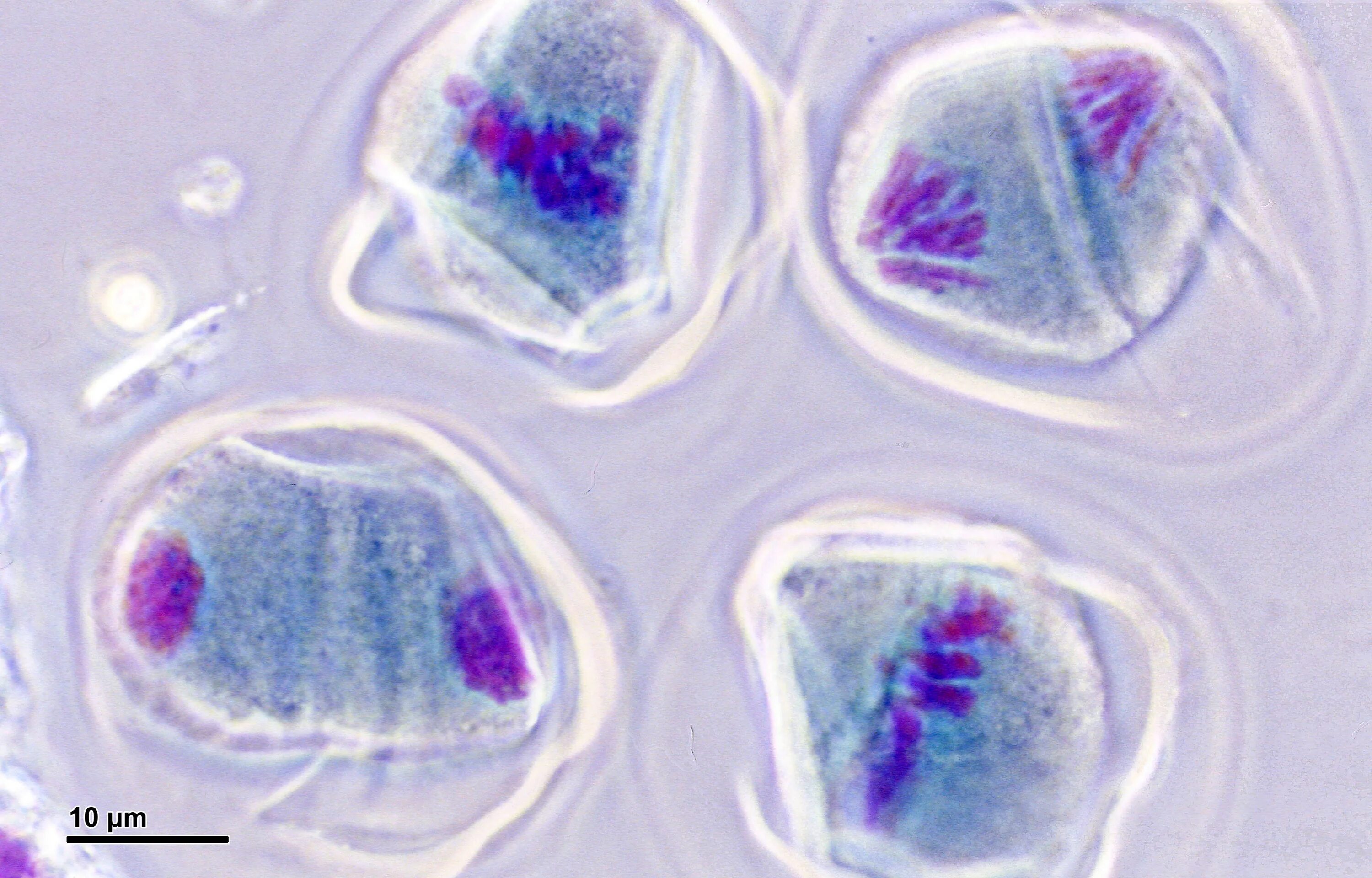 Деление клеток спорогенной ткани. Анафаза под микроскопом. Анафаза через микроскоп. Деление клетки фото. Спорогенная ткань.