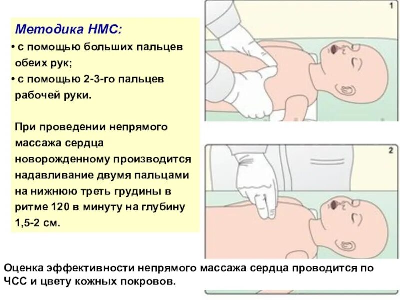 Нмс сайт