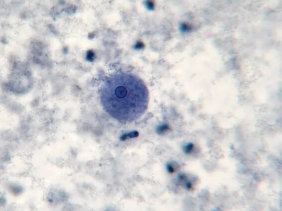 Entamoeba coli в кале. Entamoeba histolytica под микроскопом. Цисты Entamoeba. Entamoeba dispar цисты. Entamoeba histolytica trophozoite.