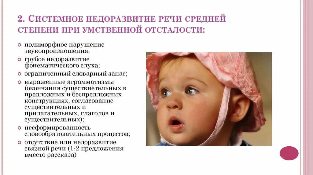 Нарушения речи у детей статья. Системное недоразвитие речи при уо. речь при умственной отсталости у детей. нарушение речи при умственной отсталости. речь при олигофрении.