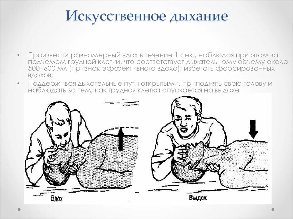 Схема искусственного дыхания. Приемы искусственного дыхания. Положение пациента при проведении искусственного дыхания. Алгоритм проведения искусственного дыхания