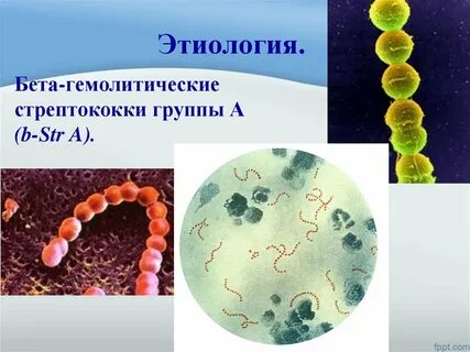 Бета гемолитический стрептококк группы b