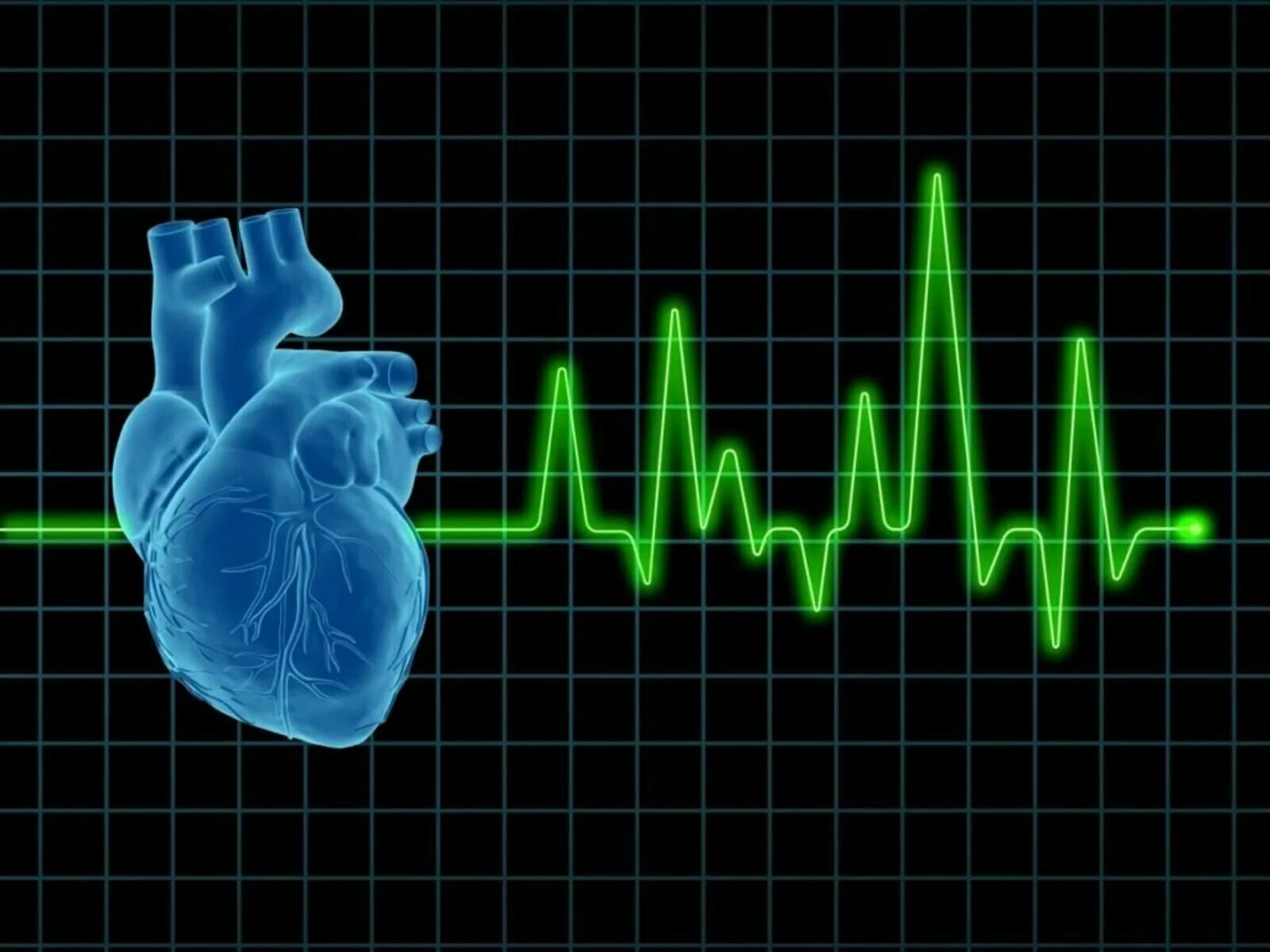 Сердце учащенное сердцебиение. "Ритм" (сердечный). Кардиология аритмии. Ритм биения сердца. Кардиограмма сердца.