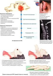 Черепно мозговая травма потеря сознания