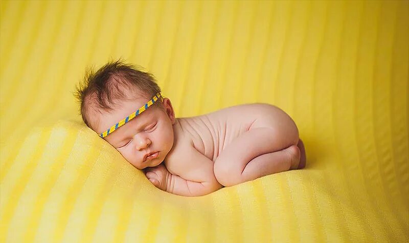 Когда вышел малыш в желтом. Желтушка у новорожденного. Ребёнок в жёлтом. Желтые Новорожденные дети. Младенец в желтом.