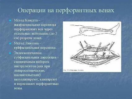 Операции верхних и нижних конечностей