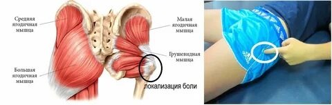 Болит бедро мягкие ткани