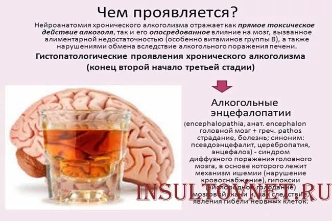 Препараты от энцефалопатии головного. Алкогольная энцефалопатия. препараты от энцефалопатии. таблетки от энцефалопатии. лекарство при энцефалопатии головного мозга.