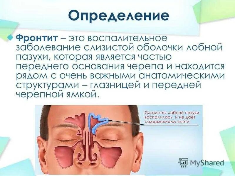 Фронтит что это такое. Острый фронтит симптомы. синусит и гайморит фронтит симптомы. воспаление пазух носа фронтит.