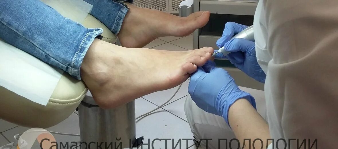 Самарский институт подологии. Институт подологии в москве. Самарский институт подологии. Подология прижигание азотной кислотой видео-курс. , 27, самара фото.