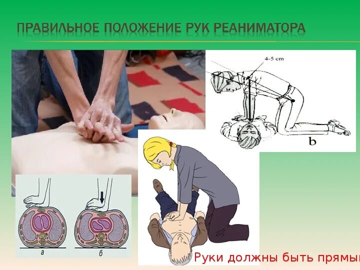 ОСНОВНЫЕ ПРИНЦИПЫ ОКАЗАНИЯ СЕРДЕЧНО-ЛЕГОЧНОЙ РЕАНИМАЦИИ