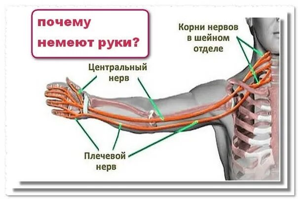 Болит и немеет правая рука. Немеют руки.