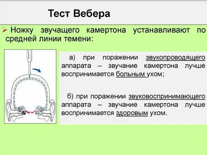 Устройство вебера
