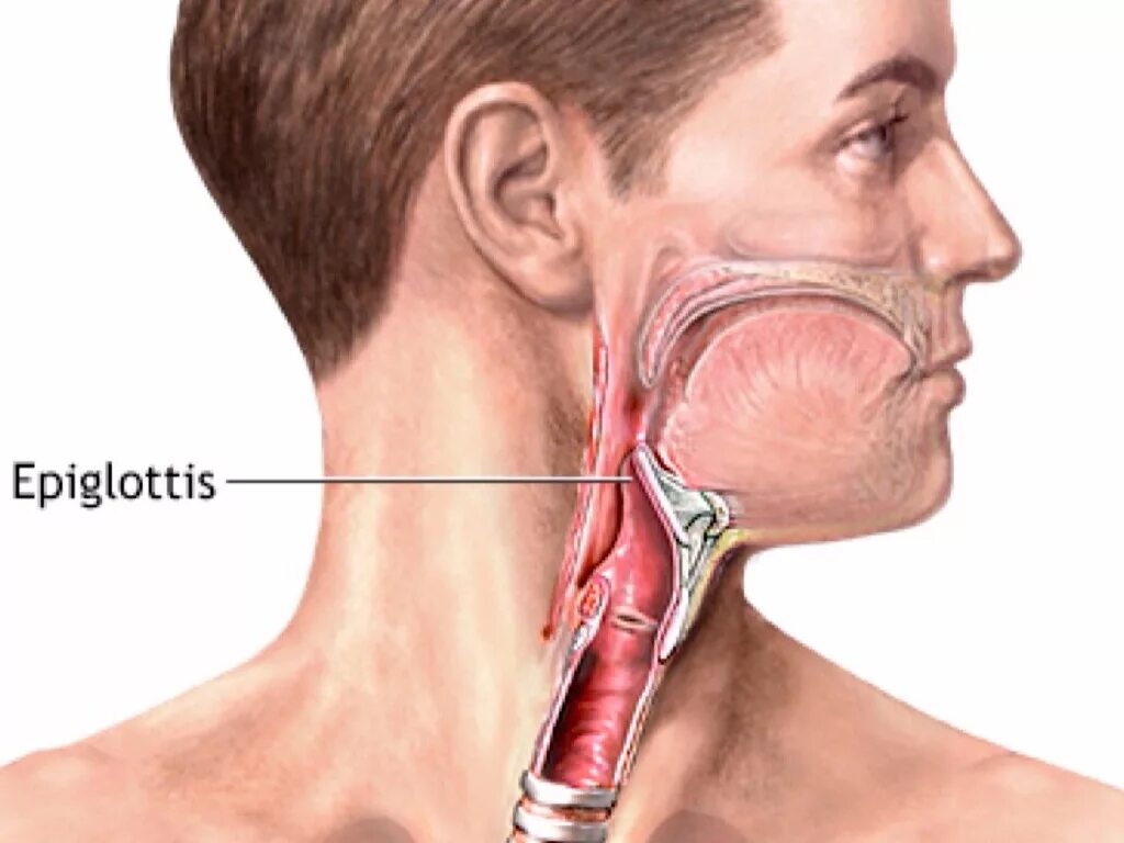 Глотка игрушки. Эпиглоттит надгортанник. Эпиглоттит воспаление надгортанника. Эпиглоттит эпиглоттит острый что это.