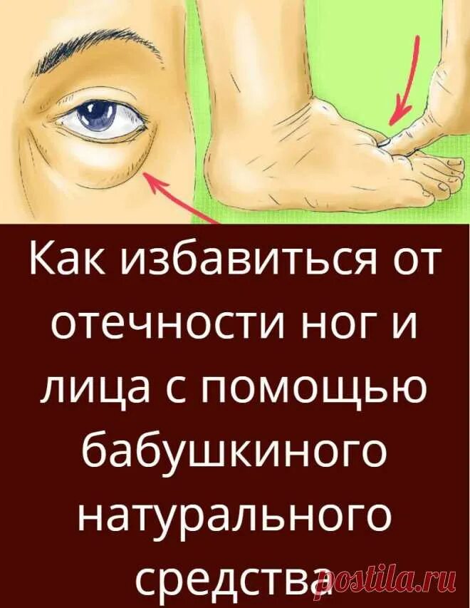 Тусклый цвет лица. Впалые круги под глазами. Мимические морщины. Отёки на лице причины причины. Как быстро убрать отёк с л.