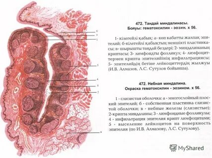 Околоушная слизистая железа