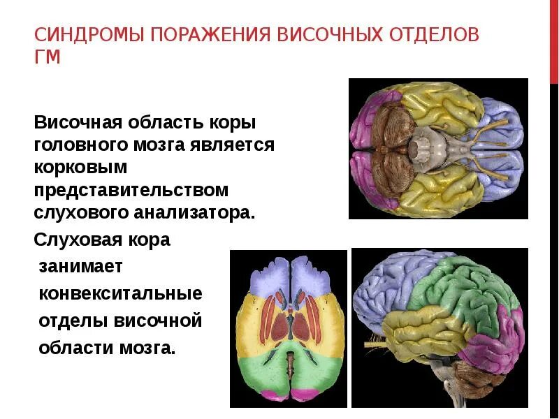 Синдромы поражения отделов коры головного мозга. Поражение конвекситальных отделов лобных долей мозга. Синдромы поражения лобных долей мозга. Синдромы поражения коры
