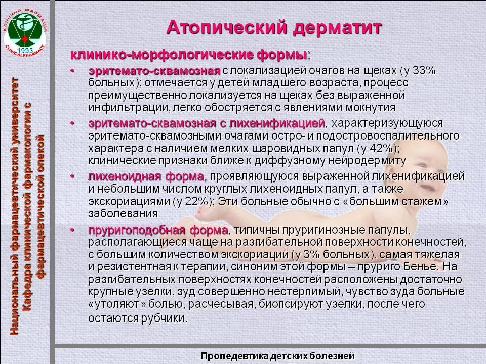 Лечение атопического дерматита. Формы атопического дерматита. клинические формы атопического дерматита. клиничнскиеформы атопического дерматтта.