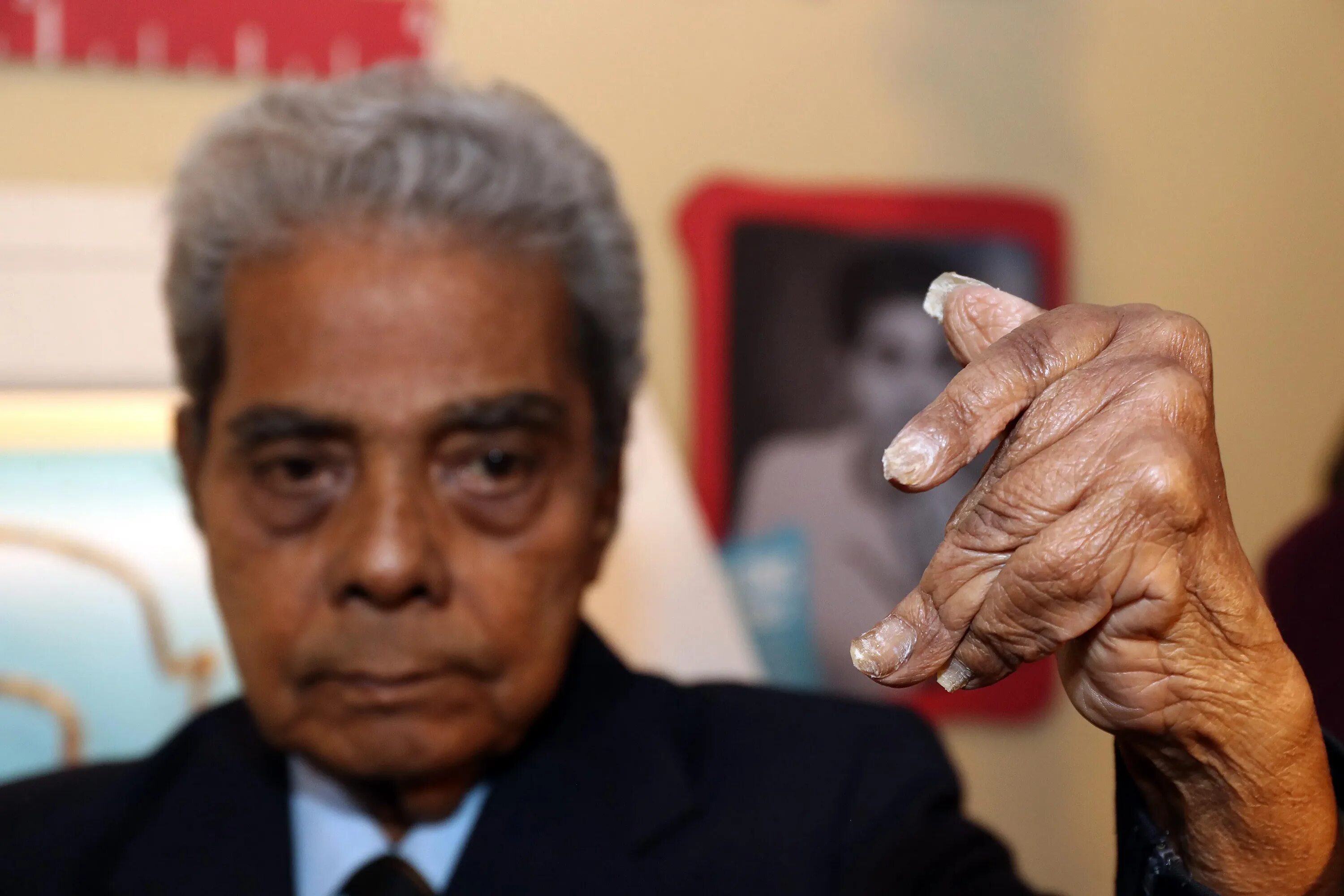 Книга рекордов ногтей. Шридхар Чиллал. Шридхар Чиллал ногти. Индиец Шридхар Чиллал. Шридхар Чиллал отпилил ногти.