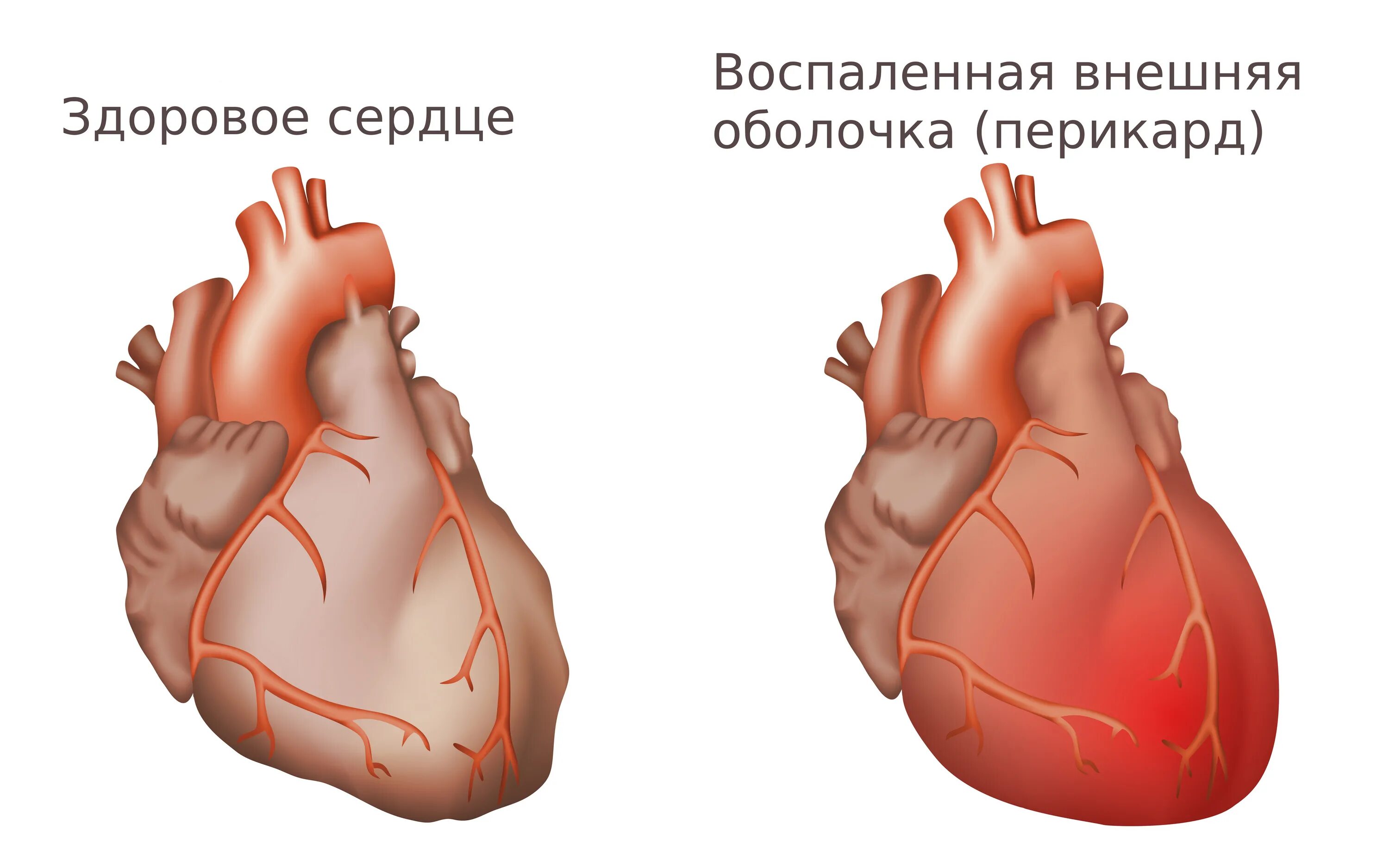 Перикард сердца анатомия.