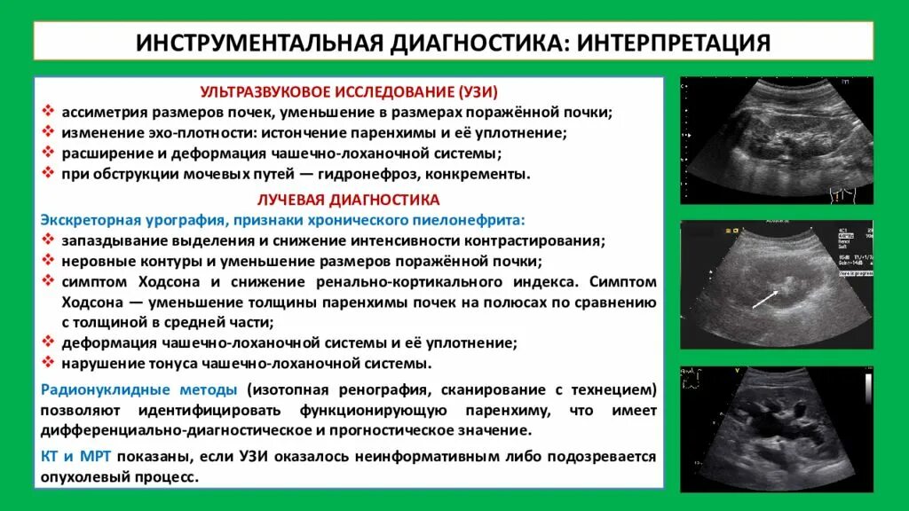 Признаки диффузных изменений обеих почек. Хронический гломерулонефрит УЗИ почек заключение. Хронический гломерулонефрит УЗИ. Острый гломерулонефрит УЗИ почек. Гломерулонефрит на УЗИ почек.