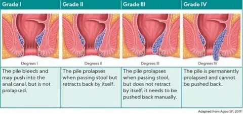 Әдемі аяқтары бар орыс порно