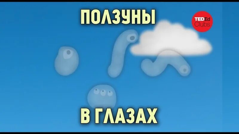 Мушки при давлении. Мушки перед глазами. плавающие мушки в глазах. летающие мушки перед глазами. мушки перед глазами причины.