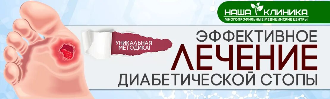 Диабет центр нижний. Кабинет диабетической стопы. препараты при диабетической стопе. обработка диабетической стопы. центр диабетической стопы.