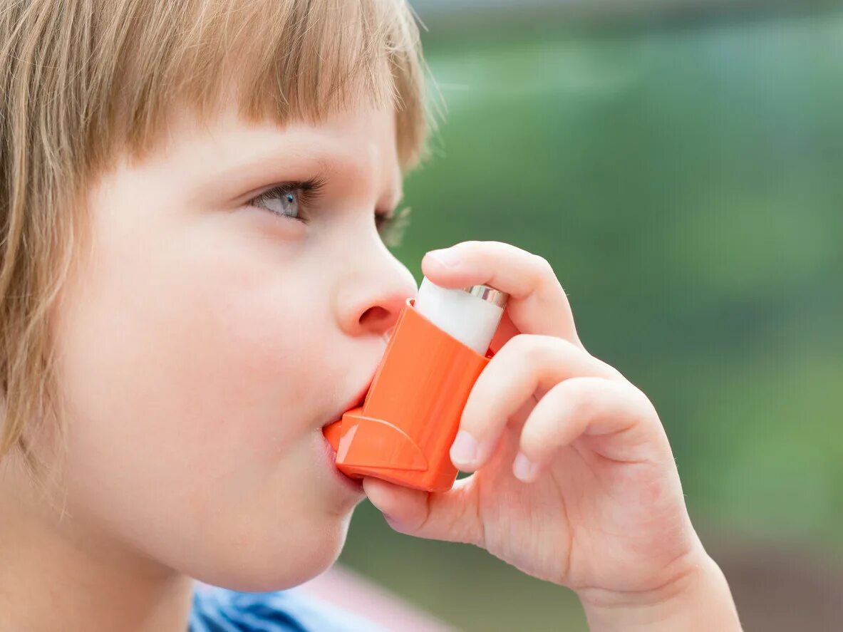 Bronchial asthma