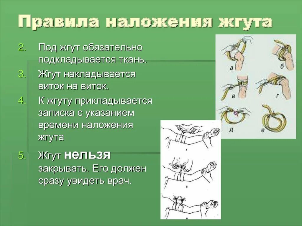 Как пишется жгут. Назовите 6 основных правил наложения жгута.. обязательное требование после наложения жгута. порядок нанесения жгута. какие требования необходимо соблюдать при наложении жгута.