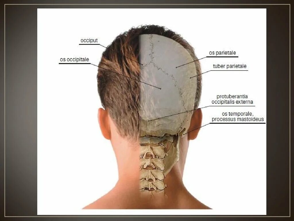 Кость в затылочной части головы. В правом черепе